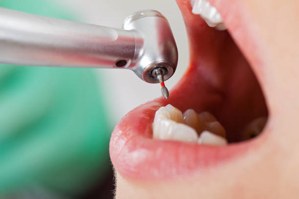 Best Emergency Dentist for Lost Fillings or Crowns in Gold Beach, OR